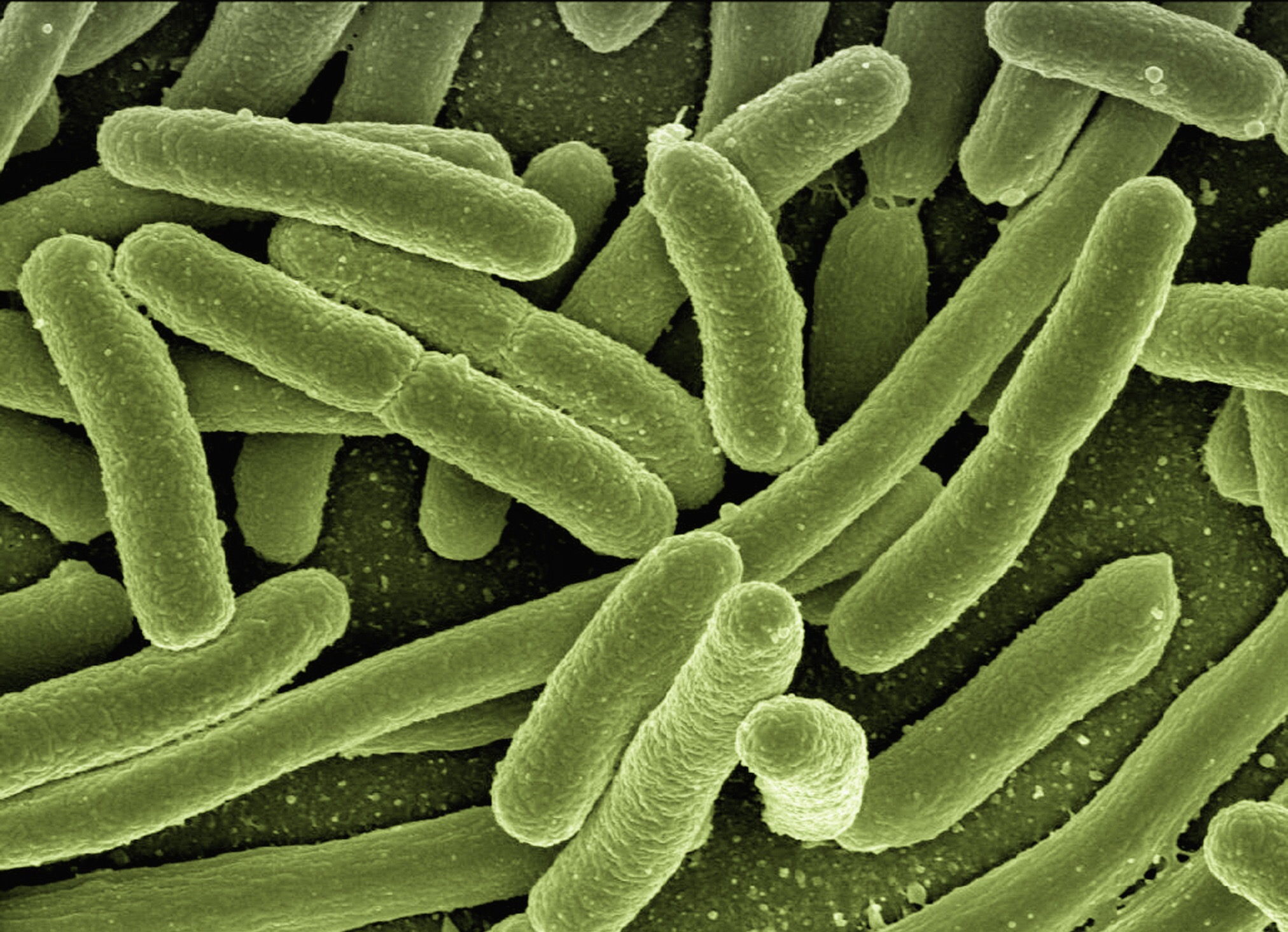 Five answers to the question ‘why microbes?’